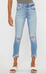 KITSON HIGH RISE ANKE SKINNY JEANS